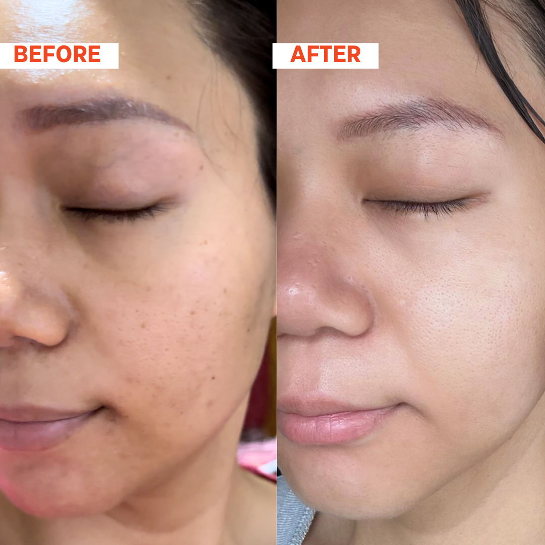 REGENEX™ Renewal Serum 35ml