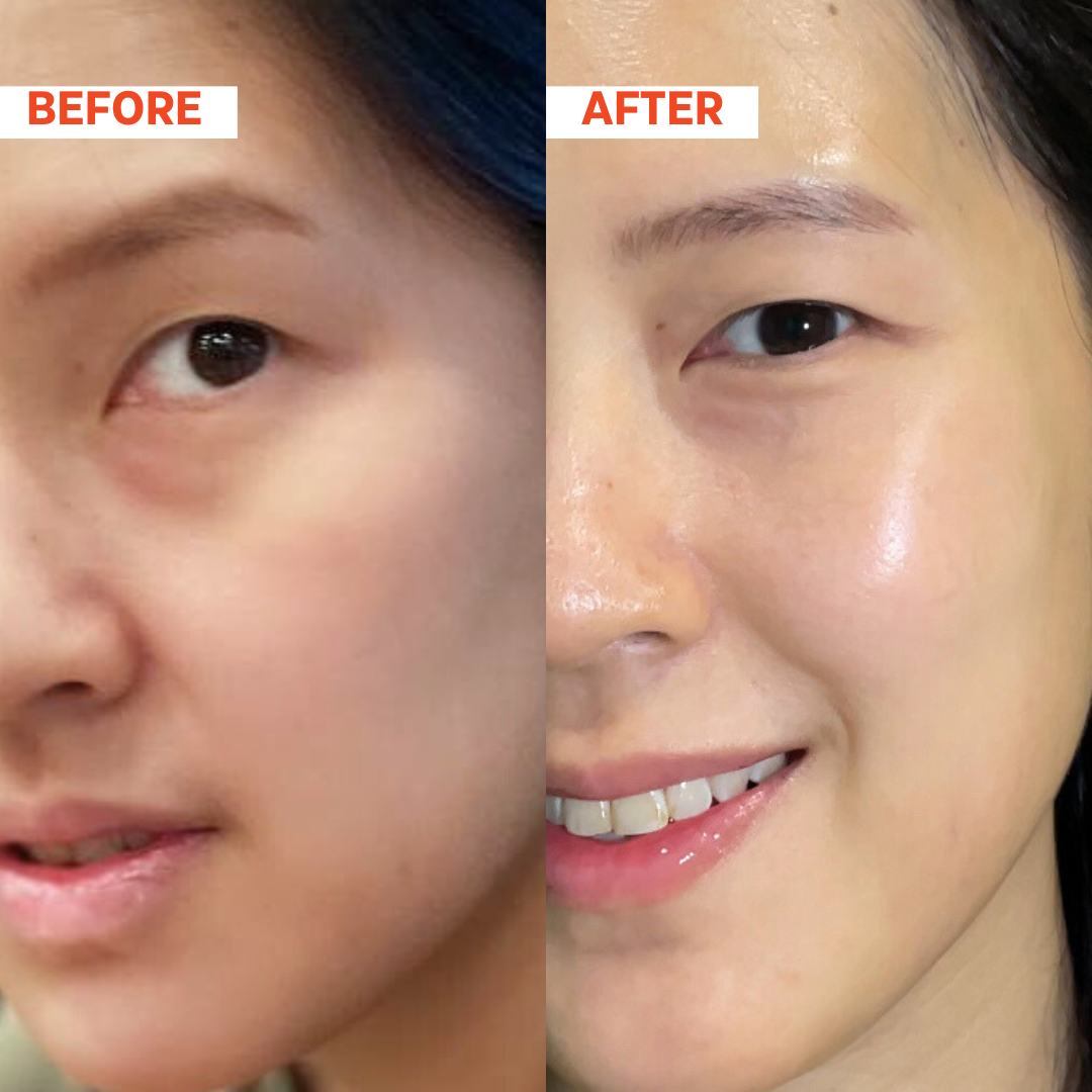 REGENEX™ Renewal Serum 35ml